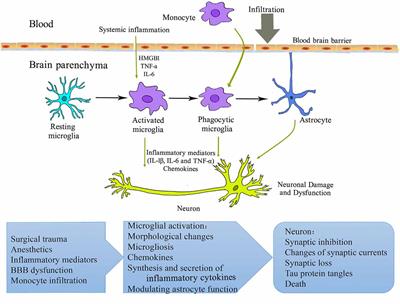 The Role of Microglia in Perioperative Neurocognitive Disorders